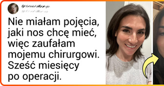 16 porównań zdjęć pokazujących zaskakującą różnicę