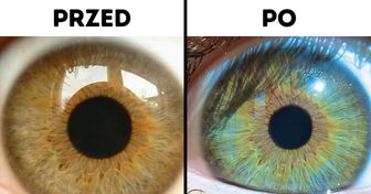 7 czynników, które mogą zmienić kolor oczu
