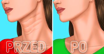6 sposobów na redukcję zmarszczek na szyi