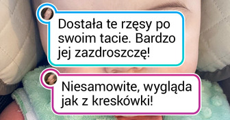 19 osób, które dostały wyjątkowy prezent od natury