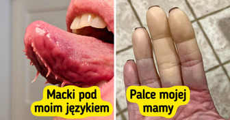 15 osób, które wyglądają jak przerobione w Photoshopie — ale to 100% natura