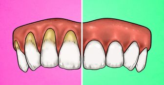 4 objawy świadczące o tym, że myjesz zęby za mocno, i jak temu zaradzić