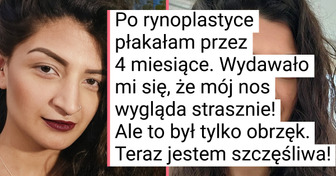 28 porównań zdjęć, które pokazują niezwykłą różnicę