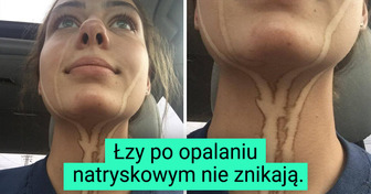 15 osób tak pechowych, że aż chce się je uściskać