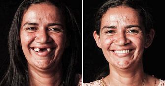 Brazylijski dentysta podróżuje po świecie i za darmo przywraca biednym ludziom uśmiech na twarzy