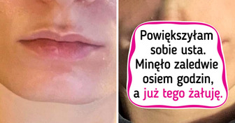 18 zestawień zdjęć, które pokazują różnicę lepiej niż tysiąc słów