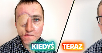 Tatuażystka tworzy hiperrealistyczne oko — od tragedii do triumfu po wypadku samochodowym
