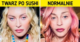 Czym jest „sushi face” i 5 sposobów na uniknięcie opuchlizny twarzy