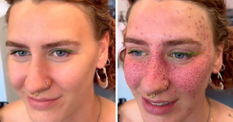 Moda na tatuowanie „trwałych piegów” na twarzy podzieliła internautów