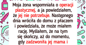 Nie zgadzałem się na operację plastyczną żony, dopóki nie poznałem prawdy