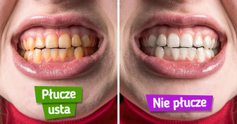 6 błędów w szczotkowaniu zębów, które pozbawiają cię szansy na hollywoodzki uśmiech