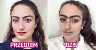 Kobieta przestała depilować twarz i rok później opowiada, jak zmieniło się jej życie