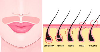 9 naturalnych i skutecznych sposobów na usuwanie owłosienia twarzy