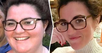20 internautów pokazuje, jak utrata wagi zmieniła ich twarz