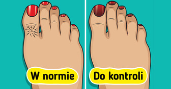 9 sygnałów od ciała, których nie warto ignorować