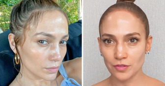 Dermatolog ujawnia, dlaczego 53-letnia J.Lo się nie starzeje. To coś więcej niż operacje plastyczne i kosmetyki