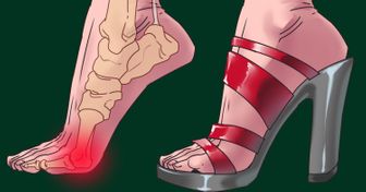 Szpilki szkodzą nie tylko stopom; mogą być też zagrożeniem dla innych części ciała