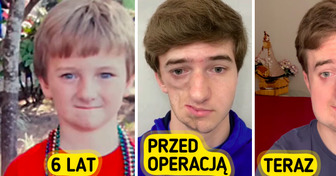 Rzadkie schorzenie młodego mężczyzny sprawiło, że został internetowym bohaterem