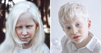 Artystka ukazuje na fotografiach zjawiskową urodę albinosów