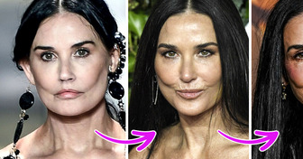 Demi Moore zrezygnowała z wypełniaczy? Eksperci zauważają zmiany
