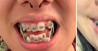 15 zdjęć, które udowadniają, że każde zęby można przekształcić w idealny uśmiech