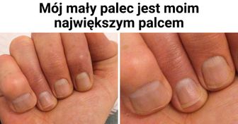 15 szczególnych cech wyglądu, które czynią ich posiadaczy naprawdę wyjątkowymi
