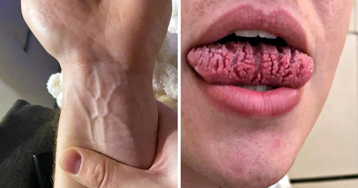 18 przypadków, gdy genetyka obdarzyła ludzi czymś absolutnie wyjątkowym