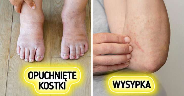 7 ważnych sygnałów, którymi nasze ciało ostrzega nas przed chorobami