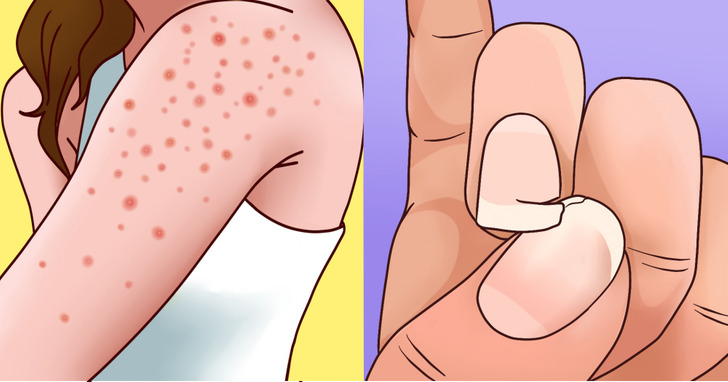 9 ważnych sygnałów, iż masz nadwrażliwość na gluten