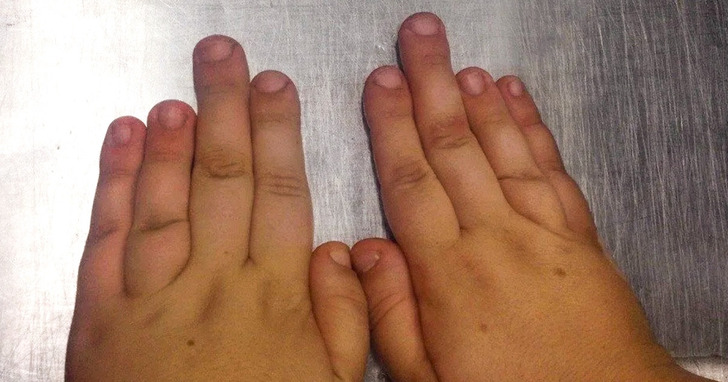 17 wyjątkowych osób, których ciała to prawdziwe cuda