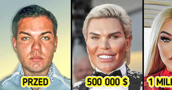 Wydałam MILION dolarów na operacje plastyczne, aby wyglądać jak lalka Barbie