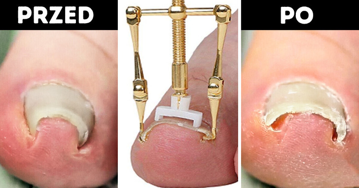 19 gadżetów ze sklepów internetowych, które zmienią twoje życie na lepsze