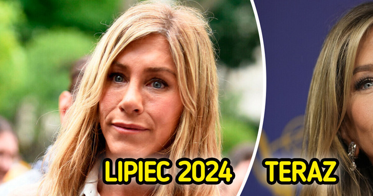 56-letnia Jennifer Aniston rezygnuje z wypełniaczy, wywołując falę komentarzy w internecie
