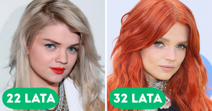 16 znanych osób, które z biegiem lat przeszły zachwycającą metamorfozę
