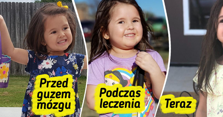 13 przypadków, gdy ludzie spojrzeli życiowym wyzwaniom w oczy i powiedzieli: „Dam radę”