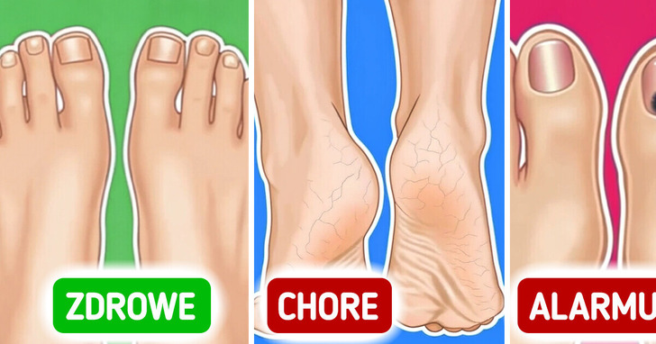 5 alarmujących sygnałów na twoich stopach, których nie wolno ignorować