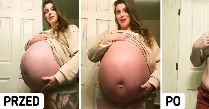 Przez ogromny brzuszek ludzie myśleli, iż młoda mama spodziewa się ósemki dzieci