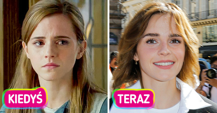 Emma Watson ujawnia, dlaczego musiała zrezygnować z aktorstwa