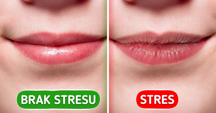 7 znaków, którymi ciało daje znać o stresie