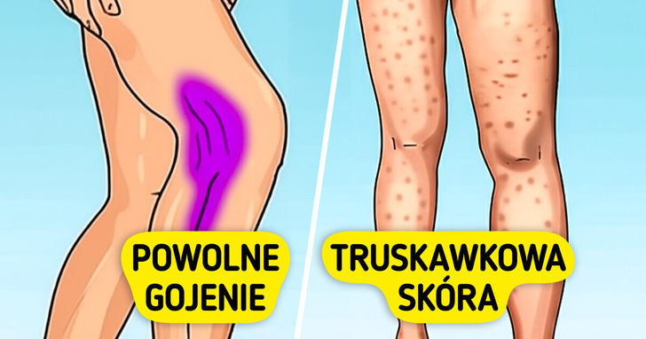 7 oznak niedoboru kolagenu, które możesz zauważyć w swoim ciele