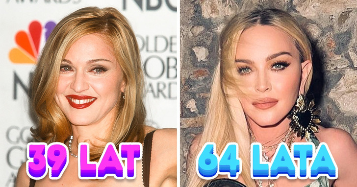 Widelec wspomagający napięcie skóry i inne sekrety, które skrywa młodzieńcza twarz Madonny