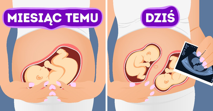 Można zajść w ciążę, będąc w ciąży. Jak to możliwe?