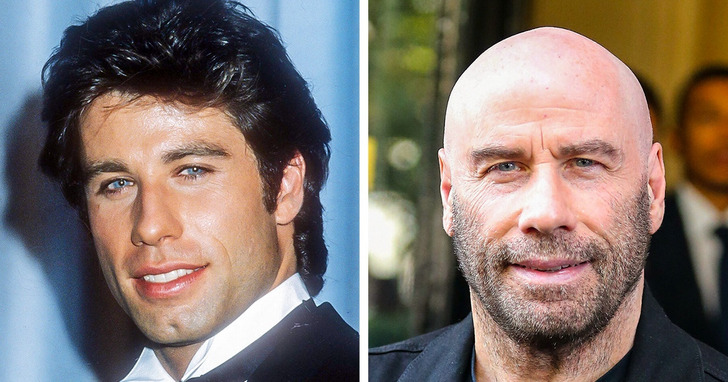 Jak wyglądali popularni celebryci, zanim postanowili ogolić głowę