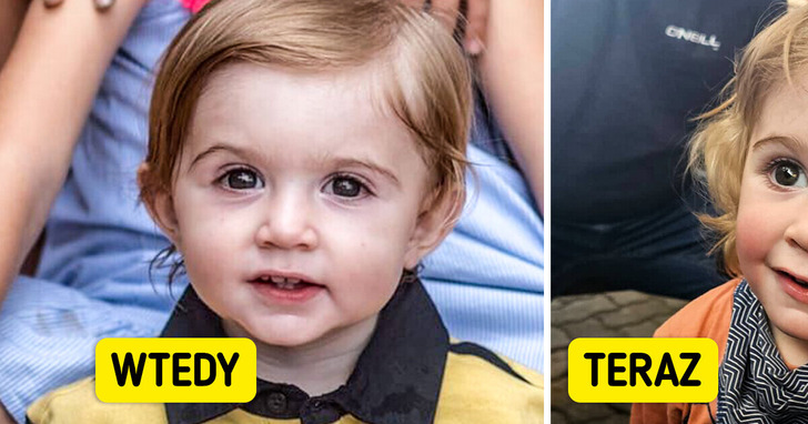 „Nigdy nie całuj cudzego dziecka!” – mama ostrzega, a lekarze walczą o oko jej synka