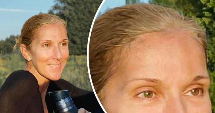 Celine Dion kończy 55 lat i opowiada o swoim "błyskawicznym liftingu" i innych sposobach na wiecznie młodą skórę twarzy