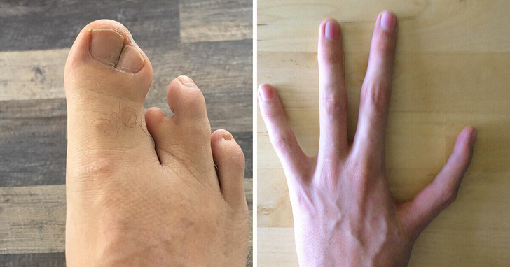 15 niewyjaśnionych zdarzeń, które przydarzyły się ludzkim ciałom