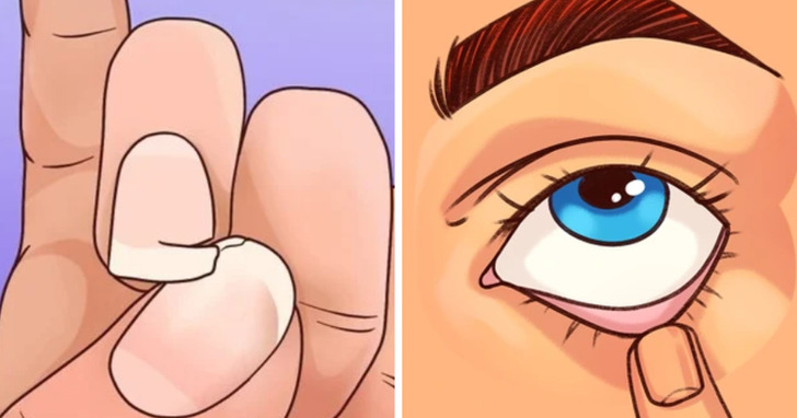 10+ oznak niedoboru żelaza w organizmie