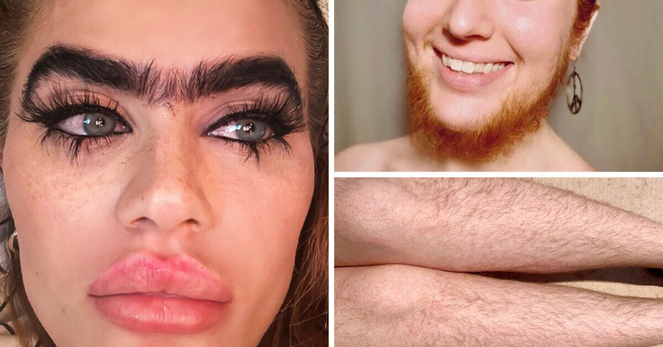 15 odważnych kobiet, które nie wstydzą się swoich włosów na ciele