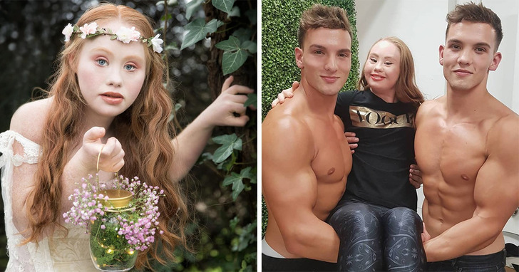 22-letnia modelka z zespołem Downa chce zostać Aniołkiem Victoria’s Secret i zmienić oblicze piękna