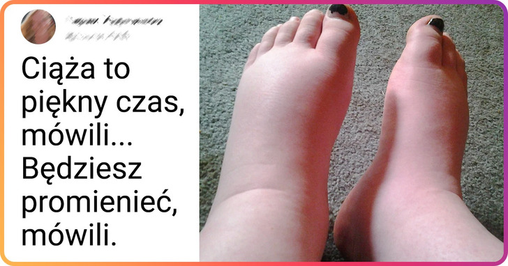 23 przypadki, w których ciąża stała się synonimem dobrej zabawy